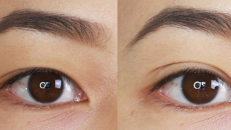 Một số người nên cân nhắc kỹ trước khi dùng kích mí